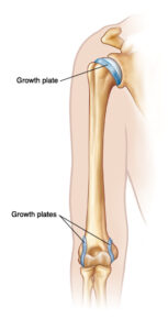 eliminating arm pain with baseball training camps